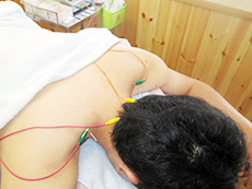 首・肩の鍼と電気治療器